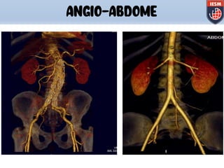 ANGIO-ABDOME
 