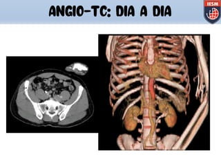 ANGIO-TC: DIA A DIA
 