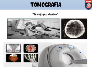 TOMOGRAFIA
“Te vejo por dentro”.
 