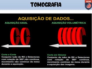 TOMOGRAFIA
 