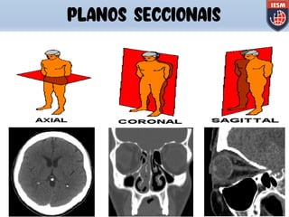 PLANOS SECCIONAIS
 