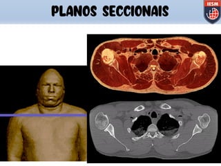 PLANOS SECCIONAIS
 