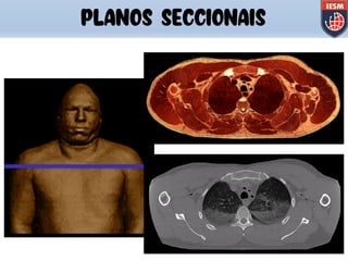 PLANOS SECCIONAIS
 