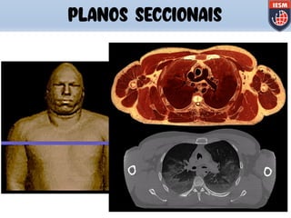 PLANOS SECCIONAIS
 