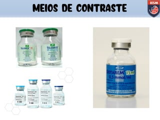 MEIOS DE CONTRASTE
 