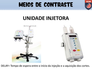 UNIDADE INJETORA
DELAY= Tempo de espera entre o início da injeção e a aquisição dos cortes.
MEIOS DE CONTRASTE
 