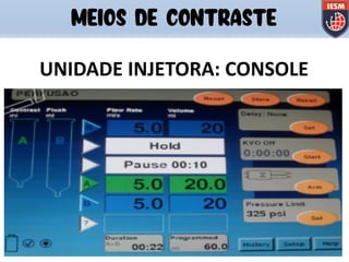 UNIDADE INJETORA: CONSOLE
MEIOS DE CONTRASTE
 
