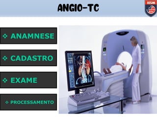 v ANAMNESE
v CADASTRO
v EXAME
v PROCESSAMENTO
ANGIO-TC
 