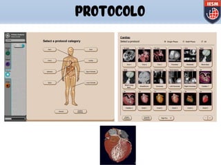 PROTOCOLO
 
