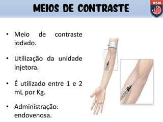 • Meio de contraste
iodado.
• Utilização da unidade
injetora.
• É utilizado entre 1 e 2
mL por Kg.
• Administração:
endovenosa.
MEIOS DE CONTRASTE
 