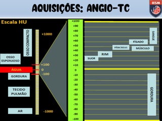 AQUISIÇÕES: ANGIO-TC
 