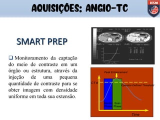 SMART PREP
q Monitoramento da captação
do meio de contraste em um
órgão ou estrutura, através da
injeção de uma pequena
quantidade de contraste para se
obter imagem com densidade
uniforme em toda sua extensão.
Scan
Phase
CT #
Peak Enhancement
Monitor
Phase
Operator-Defined Threshold
Time
AQUISIÇÕES: ANGIO-TC
 