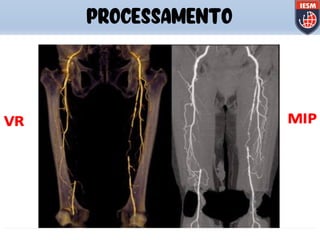 PROCESSAMENTO
 