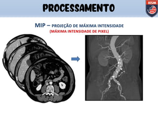 PROCESSAMENTO
 