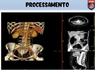 PROCESSAMENTO
 