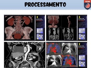 PROCESSAMENTO
 