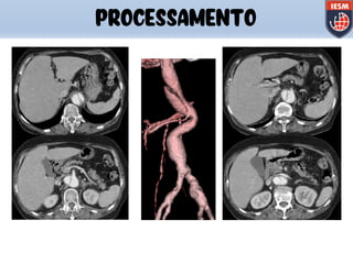 PROCESSAMENTO
 