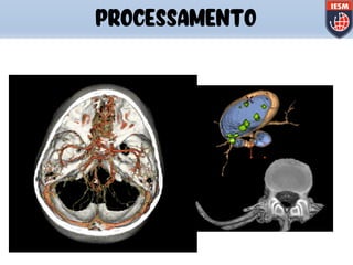 PROCESSAMENTO
 