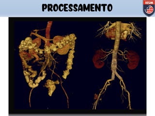 PROCESSAMENTO
 