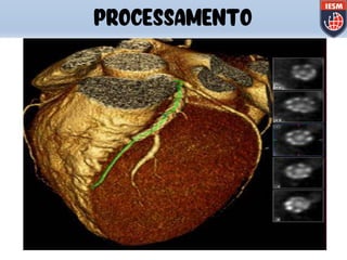 PROCESSAMENTO
 