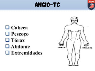 ANGIO-TC
q Cabeça
q Pescoço
q Tórax
q Abdome
q Extremidades
 