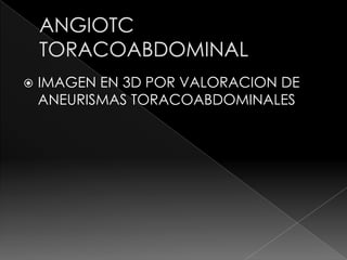    IMAGEN EN 3D POR VALORACION DE
    ANEURISMAS TORACOABDOMINALES
 