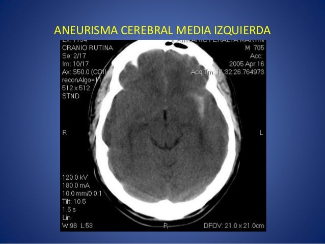 Angiotem Cuello Craneo