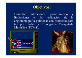 Objetivos:
• Describir indicaciones, procedimiento y
  limitaciones en la realización de la
  angiotomografia pulmonar con protocolo para
  tep por medio de Tomografía Computada
  Multislice (TCMS).
 