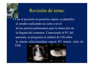 Revisión de tema:
Con el paciente en posición supina, se planifica
el estudio realizando un corte a nivel
de las arterias pulmonares para la detección de
la llegada del contraste. Conociendo la FC del
paciente, se programa el umbral de UH sobre
la arteria seleccionada(a mayor FC menor valor de
UH).
 