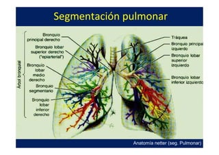 Segmentación pulmonar




              Anatomía netter (seg. Pulmonar)
 