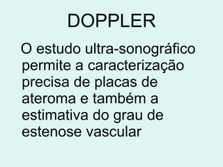 DOPPLER O estudo ultra-sonográfico permite a caracterização precisa de placas de ateroma e também a estimativa do grau de estenose vascular   
