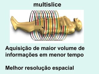 Aquisição de maior volume de informações em menor tempo Melhor resolução espacial multislice 