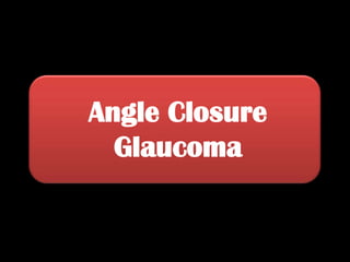 Angle Closure Glaucoma 