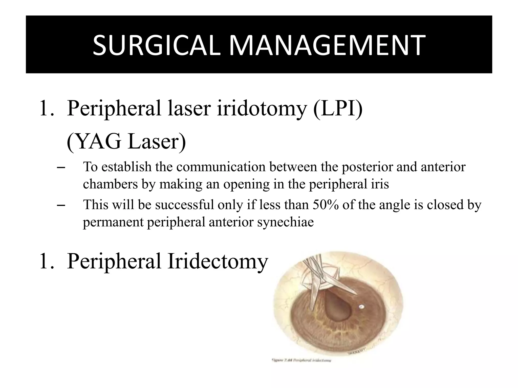SURGICAL MANAGEMENTPeripheral laser iridotomy (LPI)    (YAG Laser)To establish the communication between the posterior and anterior chambers by making an opening in the peripheral irisThis will be successful only if less than 50% of the angle is closed by permanent peripheral anterior synechiaePeripheral Iridectomy