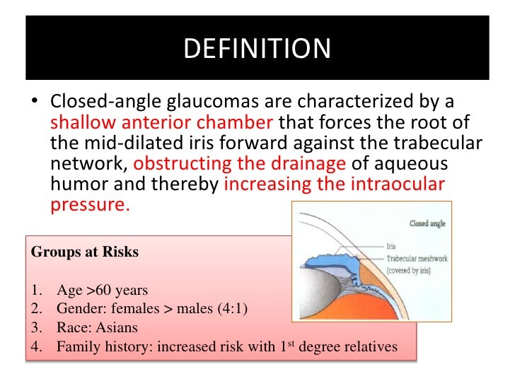 Angle Closure Glaucoma
