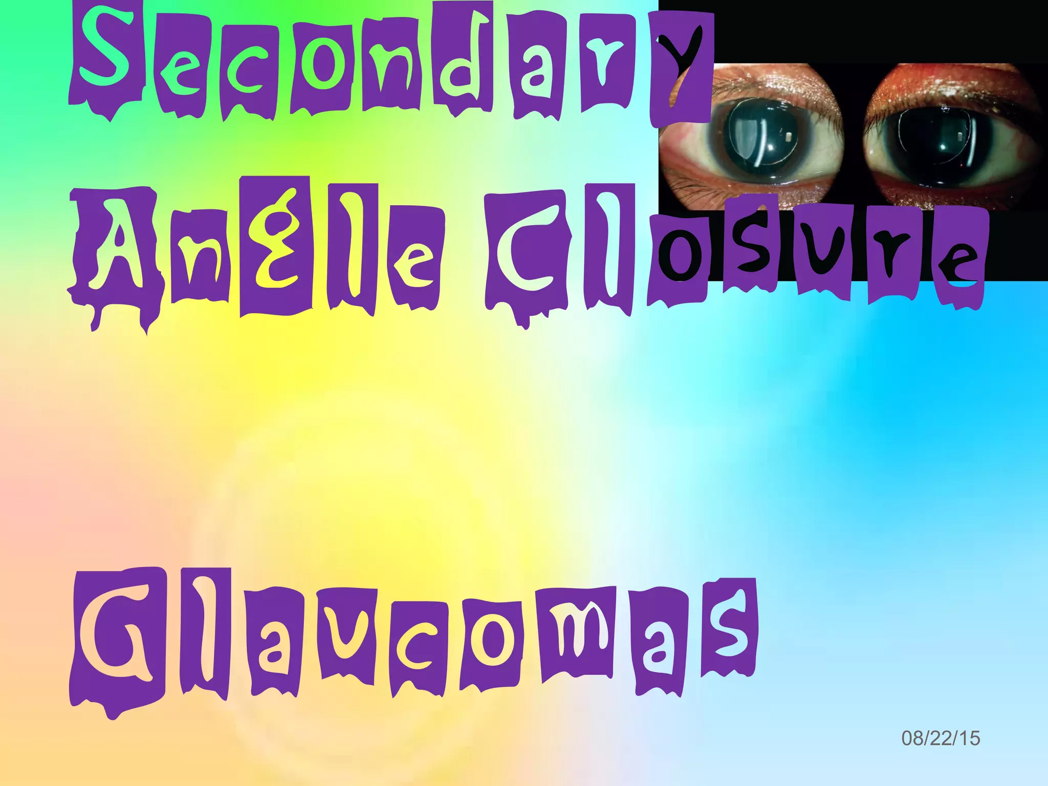 Secondary
Angle Closure
Glaucomas 08/22/15
 