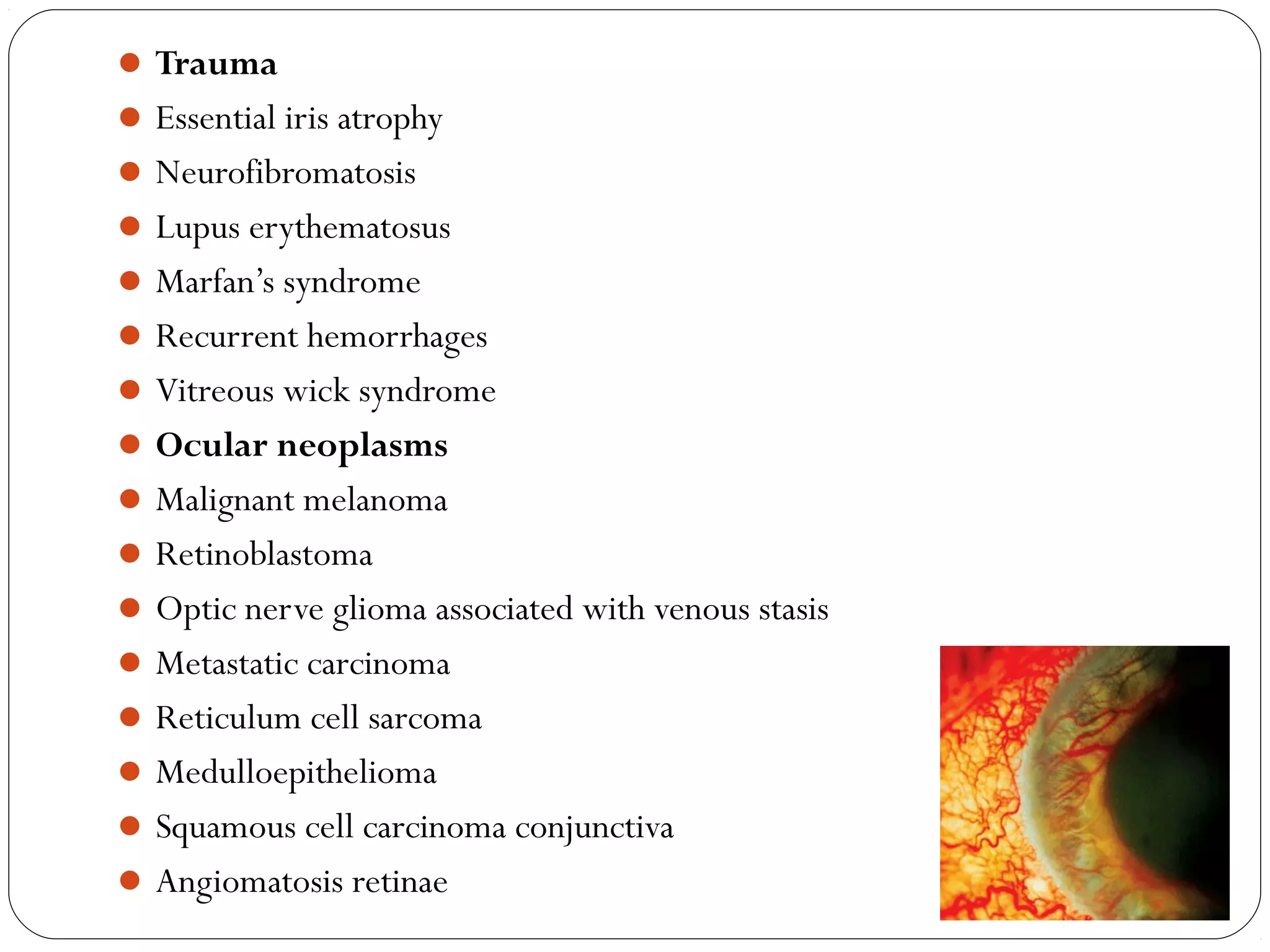 Trauma
Essential iris atrophy
Neurofibromatosis
Lupus erythematosus
Marfan’s syndrome
Recurrent hemorrhages
Vitreous wick syndrome
Ocular neoplasms
Malignant melanoma
Retinoblastoma
Optic nerve glioma associated with venous stasis
Metastatic carcinoma
Reticulum cell sarcoma
Medulloepithelioma
Squamous cell carcinoma conjunctiva
Angiomatosis retinae 08/22/15
 