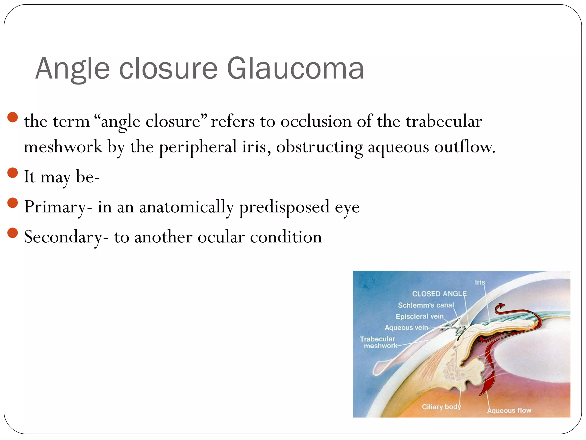 Angle closure Glaucoma
the term “angle closure” refers to occlusion of the trabecular
meshwork by the peripheral iris, obstructing aqueous outflow.
It may be-
Primary- in an anatomically predisposed eye
Secondary- to another ocular condition
 