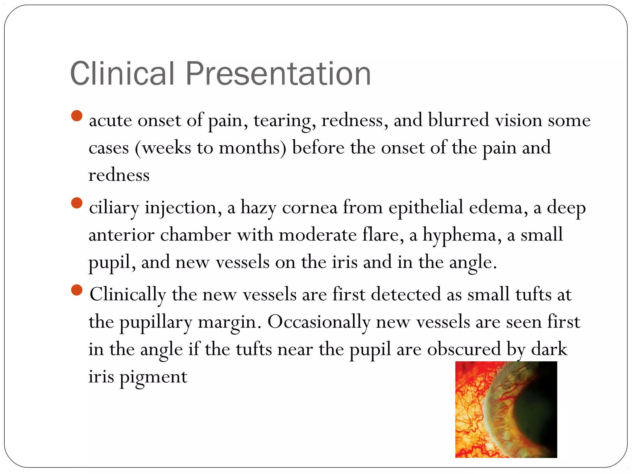 Clinical Presentation
acute onset of pain, tearing, redness, and blurred vision some
cases (weeks to months) before the onset of the pain and
redness
ciliary injection, a hazy cornea from epithelial edema, a deep
anterior chamber with moderate flare, a hyphema, a small
pupil, and new vessels on the iris and in the angle.
Clinically the new vessels are first detected as small tufts at
the pupillary margin. Occasionally new vessels are seen first
in the angle if the tufts near the pupil are obscured by dark
iris pigment
 
