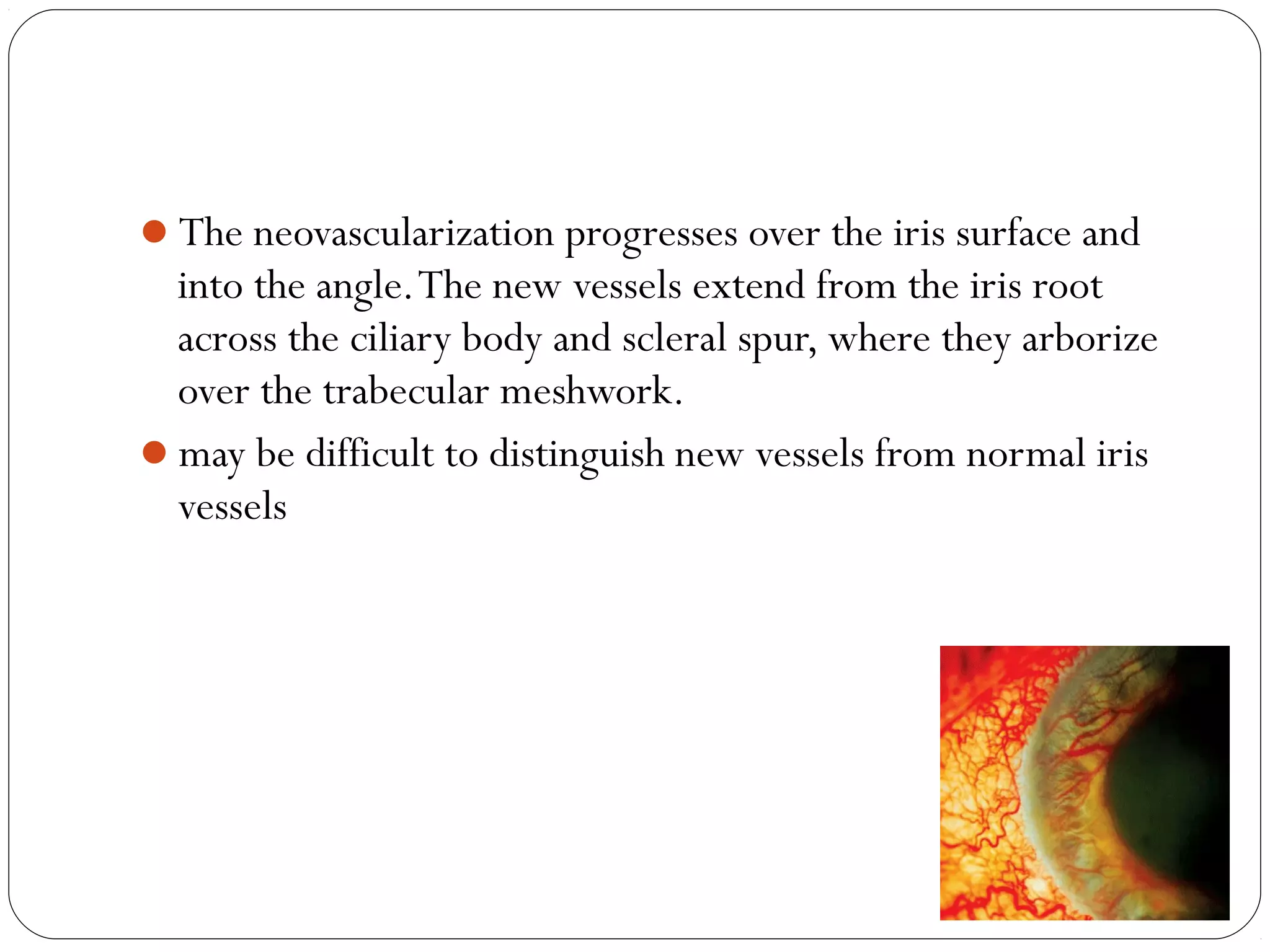 The neovascularization progresses over the iris surface and
into the angle.The new vessels extend from the iris root
across the ciliary body and scleral spur, where they arborize
over the trabecular meshwork.
may be difficult to distinguish new vessels from normal iris
vessels
08/22/15
 