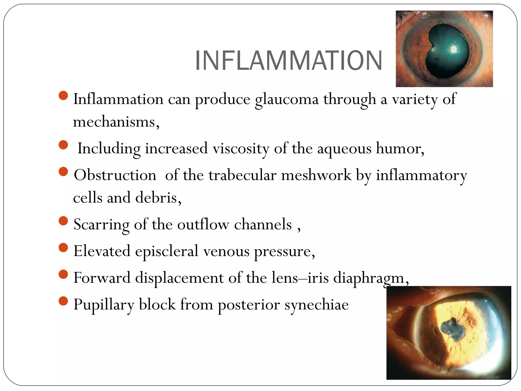 INFLAMMATION
Inflammation can produce glaucoma through a variety of
mechanisms,
 Including increased viscosity of the aqueous humor,
Obstruction of the trabecular meshwork by inflammatory
cells and debris,
Scarring of the outflow channels ,
Elevated episcleral venous pressure,
Forward displacement of the lens–iris diaphragm,
Pupillary block from posterior synechiae
 