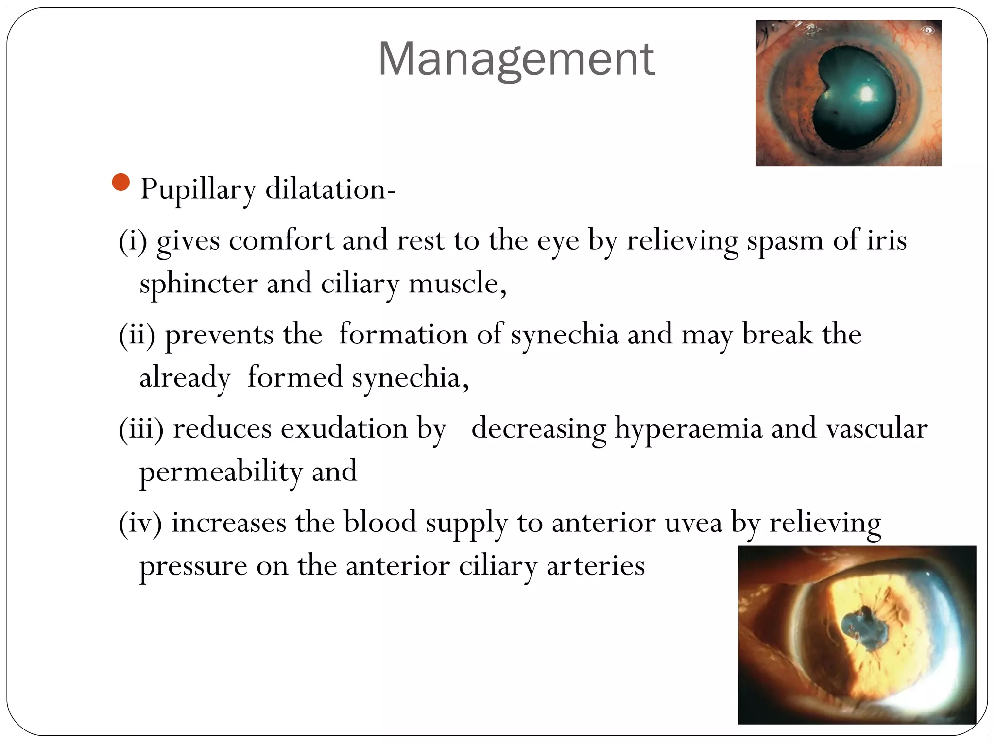 Management
Pupillary dilatation-
(i) gives comfort and rest to the eye by relieving spasm of iris
sphincter and ciliary muscle,
(ii) prevents the formation of synechia and may break the
already formed synechia,
(iii) reduces exudation by decreasing hyperaemia and vascular
permeability and
(iv) increases the blood supply to anterior uvea by relieving
pressure on the anterior ciliary arteries
 