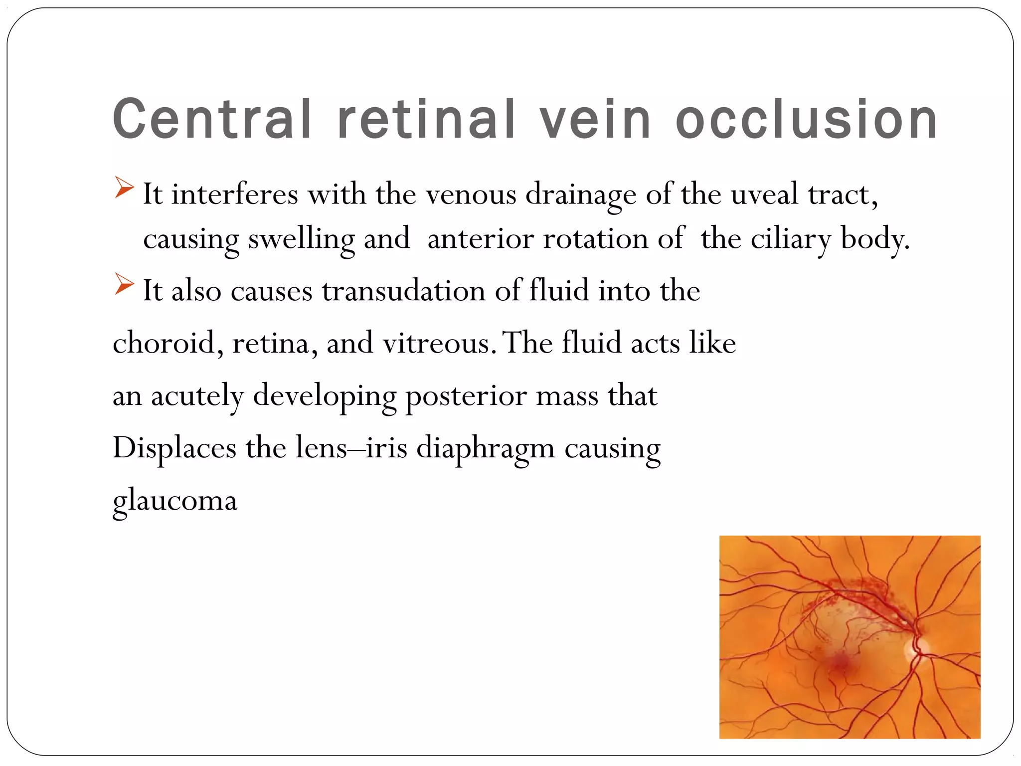 Central retinal vein occlusion
 It interferes with the venous drainage of the uveal tract,
causing swelling and anterior rotation of the ciliary body.
 It also causes transudation of fluid into the
choroid, retina, and vitreous.The fluid acts like
an acutely developing posterior mass that
Displaces the lens–iris diaphragm causing
glaucoma
 