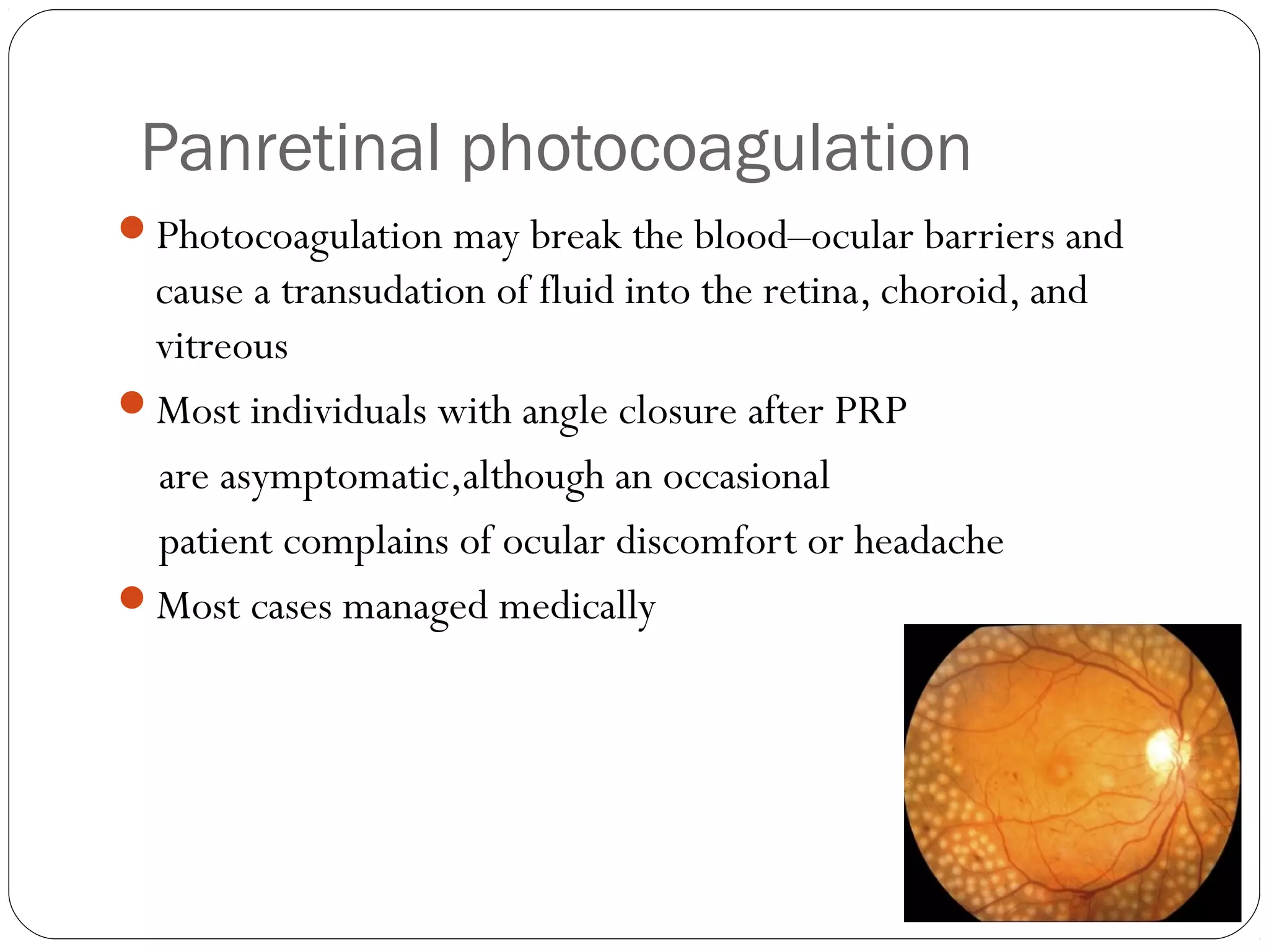Panretinal photocoagulation
Photocoagulation may break the blood–ocular barriers and
cause a transudation of fluid into the retina, choroid, and
vitreous
Most individuals with angle closure after PRP
are asymptomatic,although an occasional
patient complains of ocular discomfort or headache
Most cases managed medically
 