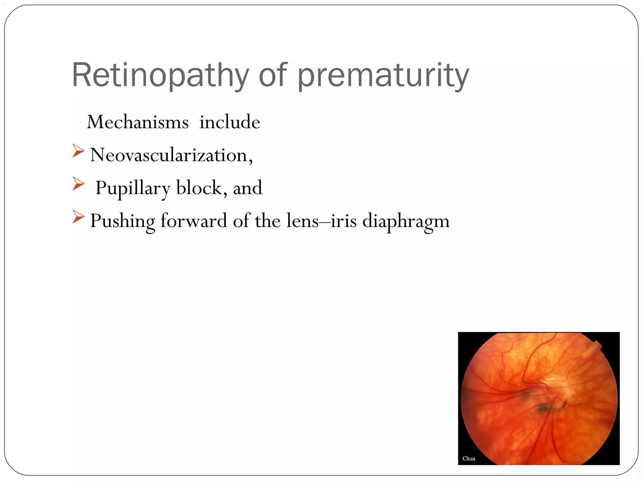 Retinopathy of prematurity
Mechanisms include
 Neovascularization,
 Pupillary block, and
 Pushing forward of the lens–iris diaphragm
 
