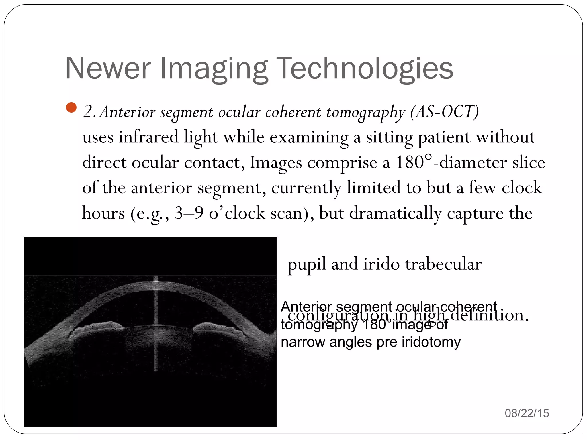 Newer Imaging Technologies
08/22/15
2.Anterior segment ocular coherent tomography (AS-OCT)
uses infrared light while examining a sitting patient without
direct ocular contact, Images comprise a 180°-diameter slice
of the anterior segment, currently limited to but a few clock
hours (e.g., 3–9 o’clock scan), but dramatically capture the
pupil and irido trabecular
configuration in high definition.Anterior segment ocular coherent
tomography 180°image of
narrow angles pre iridotomy
 
