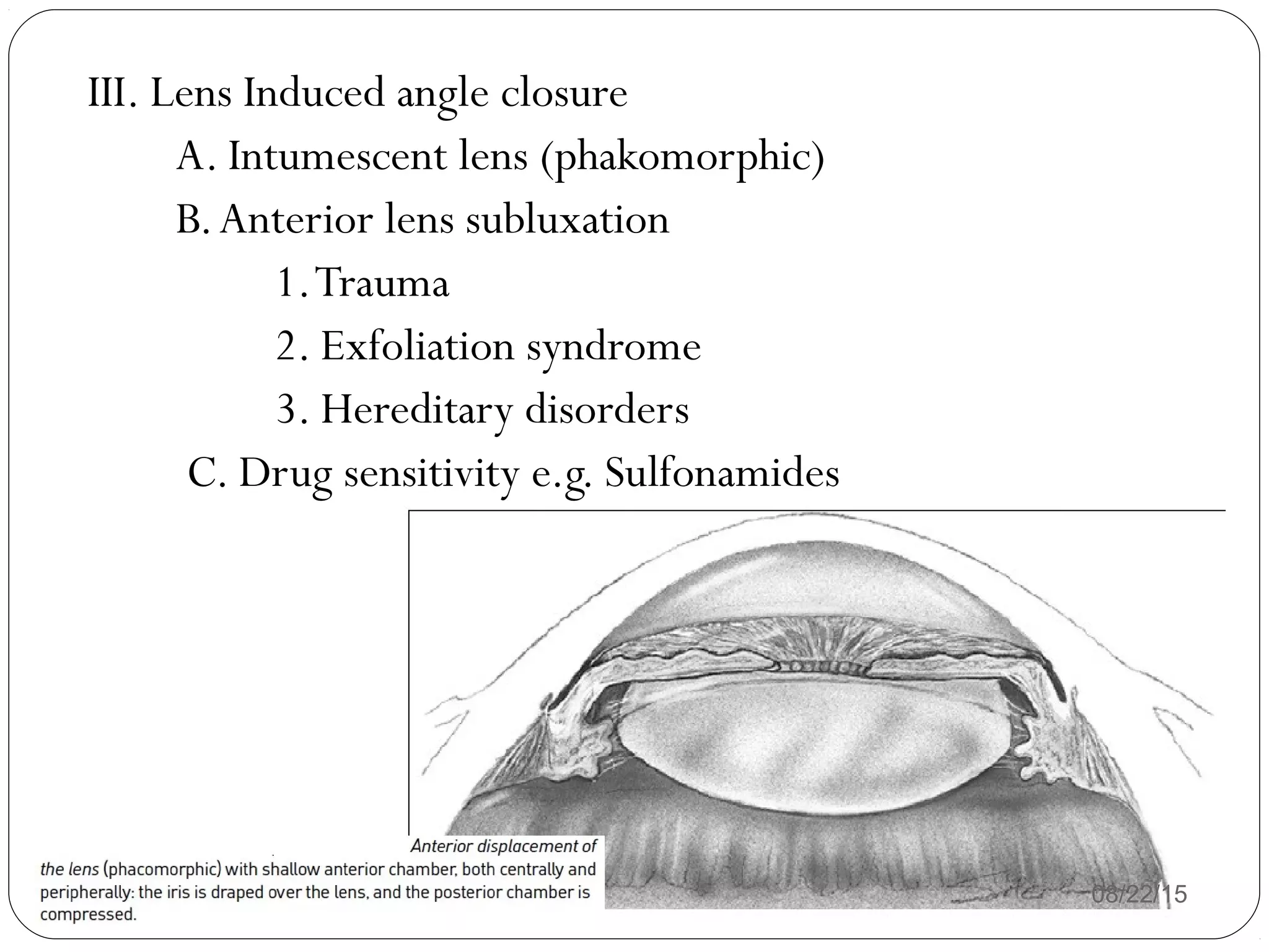 08/22/15
III. Lens Induced angle closure
A. Intumescent lens (phakomorphic)
B.Anterior lens subluxation
1.Trauma
2. Exfoliation syndrome
3. Hereditary disorders
C. Drug sensitivity e.g. Sulfonamides
 
