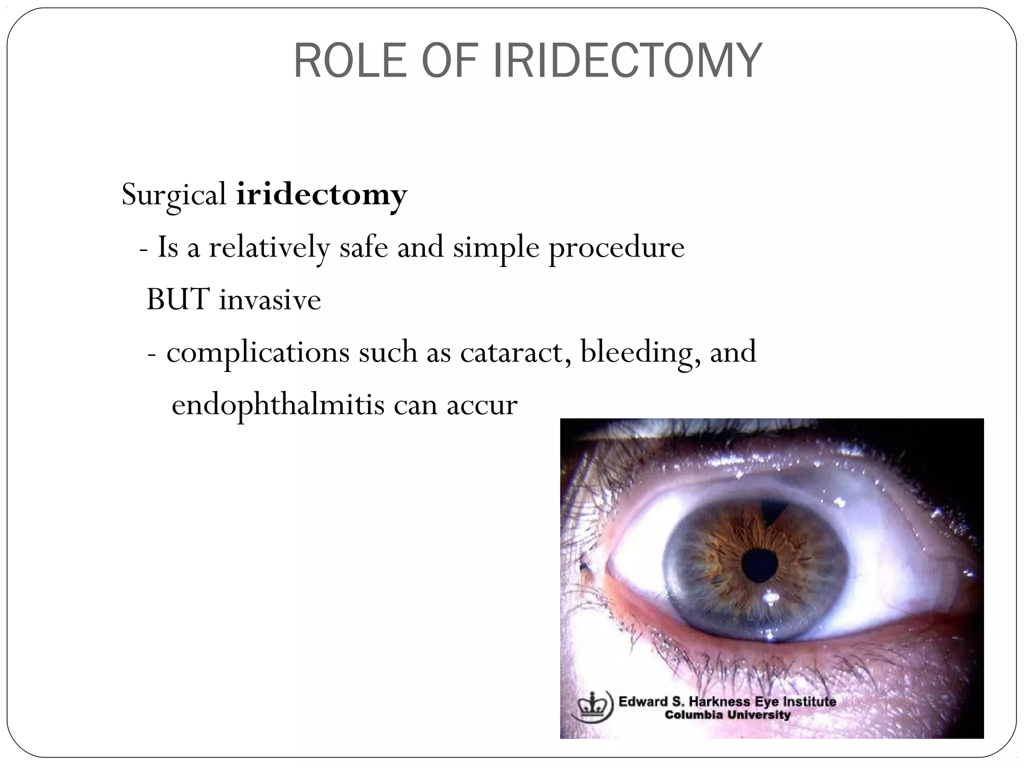 ROLE OF IRIDECTOMY
Surgical iridectomy
- Is a relatively safe and simple procedure
BUT invasive
- complications such as cataract, bleeding, and
endophthalmitis can accur
 