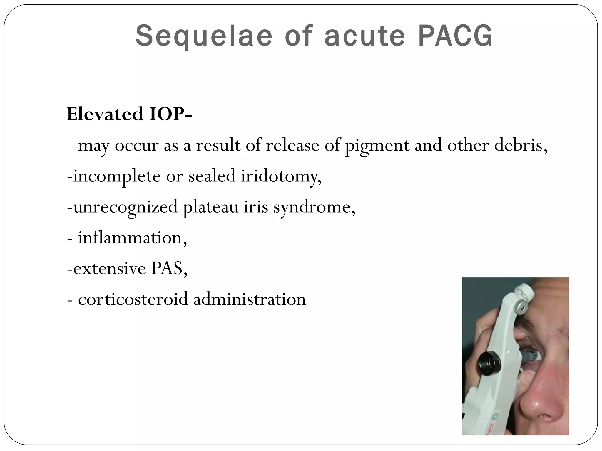 Sequelae of acute PACG
Elevated IOP-
-may occur as a result of release of pigment and other debris,
-incomplete or sealed iridotomy,
-unrecognized plateau iris syndrome,
- inflammation,
-extensive PAS,
- corticosteroid administration
 