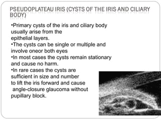 •Primary cysts of the iris and ciliary body
usually arise from the
epithelial layers.
•The cysts can be single or multiple and
involve oneor both eyes
•In most cases the cysts remain stationary
and cause no harm.
•In rare cases the cysts are
sufficient in size and number
to lift the iris forward and cause
angle-closure glaucoma without
pupillary block.
 